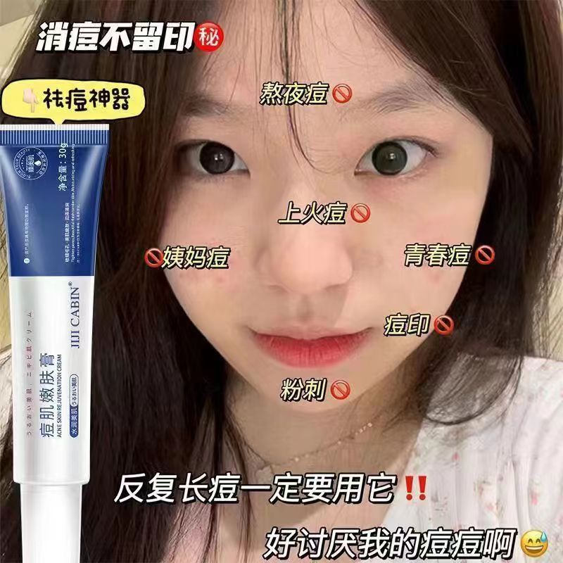 祛痘膏祛痘印淡化痘印去痘坑粉刺修复男女学生青春痘痘去痘膏专用