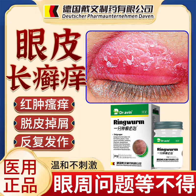 眼皮长癣痒红肿瘙痒脱皮掉屑神经性皮炎眼皮癣干燥起皮反复抓挠qo