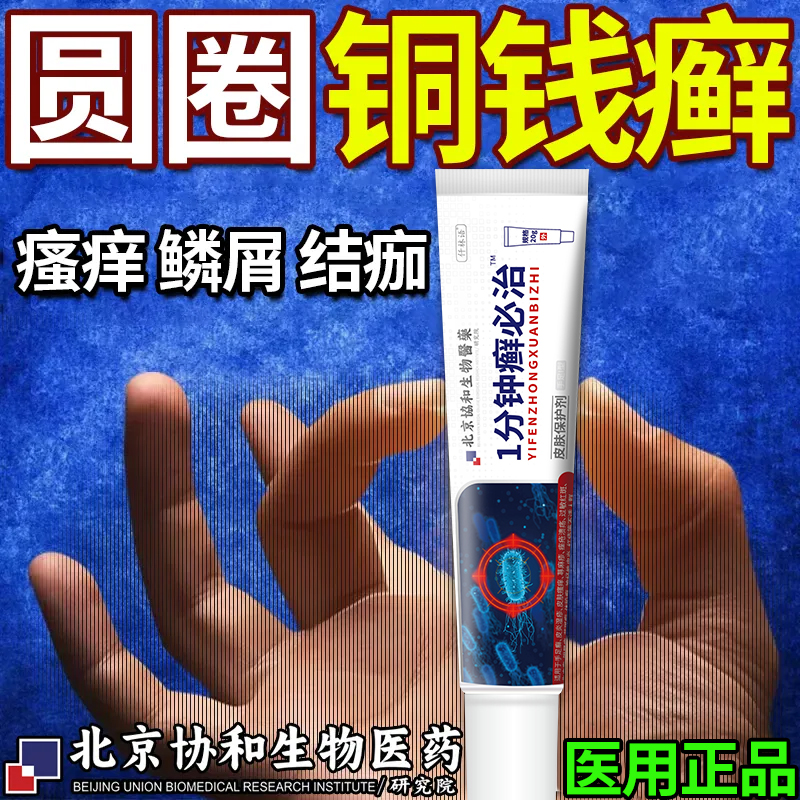 铜钱癣铜钱藓皮肤瘙痒止痒抑菌杀菌专用膏医用正品可搭药膏贴用qo