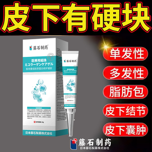 皮下鼓包硬块皮下结节囊肿纤维瘤膏单发性多发性脂肪瘤可搭配膏药