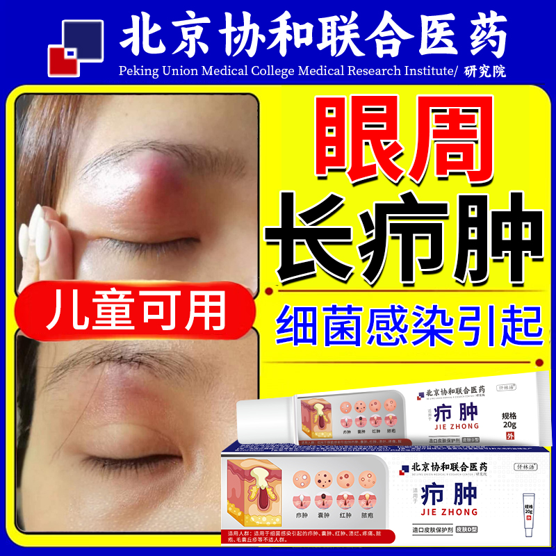 眼周长疖肿细菌感染疖肿拔毒膏皮脂腺囊肿火疖子可搭膏药贴肿痛qo