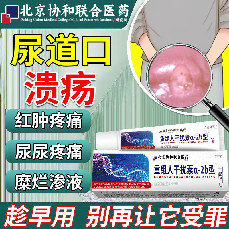 尿道口溃疡发炎流脓梅毒感染生殖器疱疹红肿溃烂疼痛可搭药膏贴qo