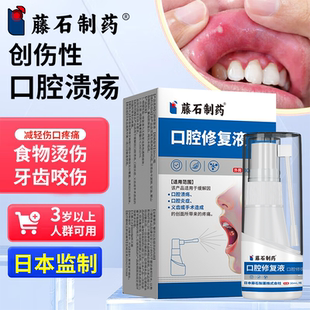 创伤性口腔溃疡口腔黏膜修复口腔溃疡喷剂嘴巴烫伤咬伤起泡缓疼痛