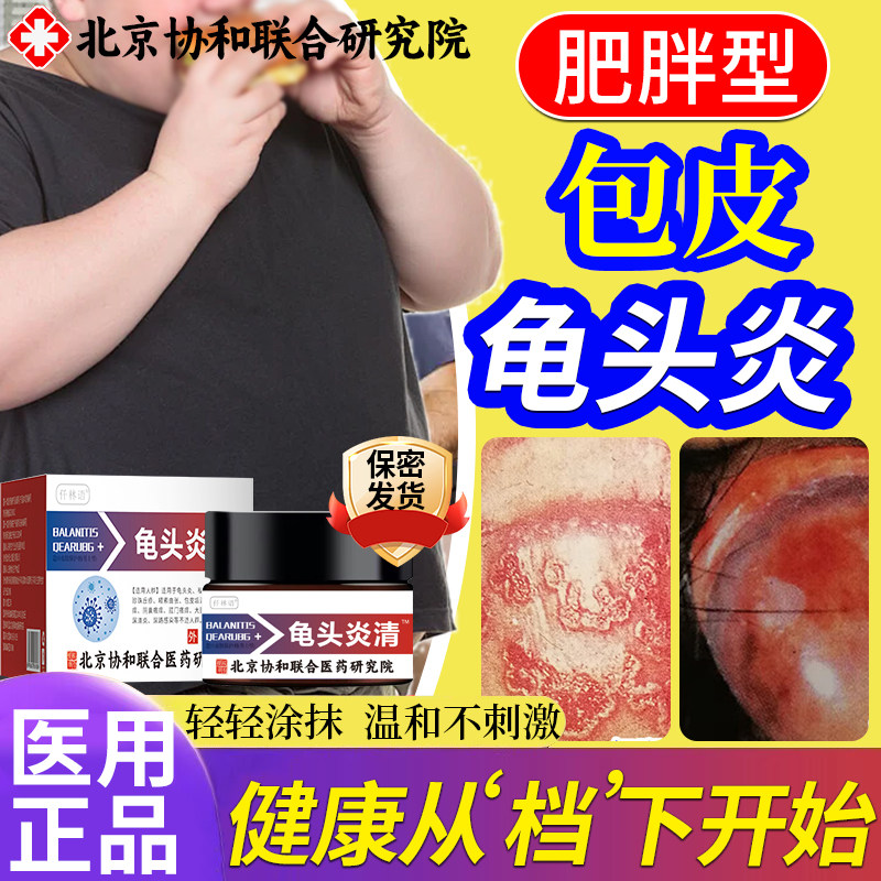男性包皮龟头炎肥胖型红肿充血水肿糜烂疼痛霉菌性可搭配膏药贴qo