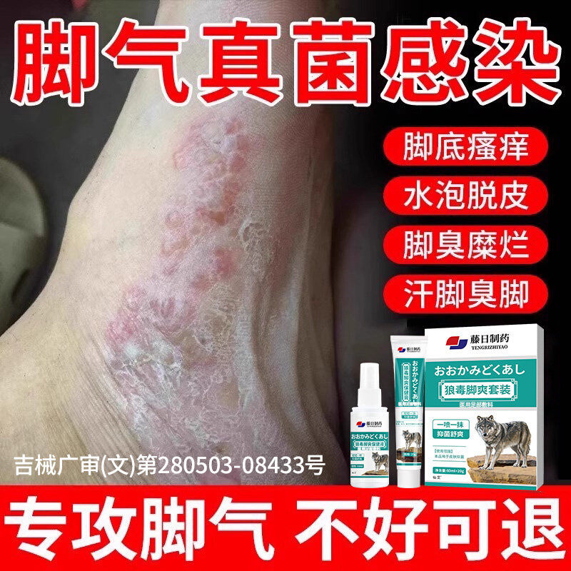 脚气喷雾止脱皮痒杀菌去真菌感染专用糜烂脚丫脚趾缝除臭出汗膏
