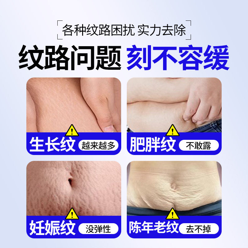 生长纹消除大腿青少年去除肥胖纹修复霜学生儿童专用妊娠纹紧致