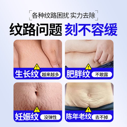 生长纹消除大腿青少年去除肥胖纹修复霜学生儿童专用妊娠纹紧致