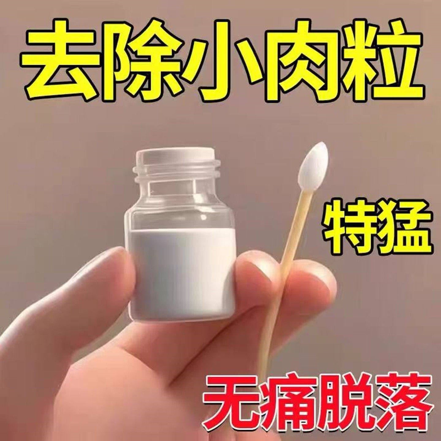 祛除脖子上长的瘊子小肉粒疙瘩肉痣肉刺祛疣体肉疣皮赘专用神器