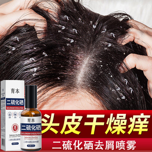 头皮干痒保湿头屑多去屑止痒滋养营养二硫化硒去屑喷雾