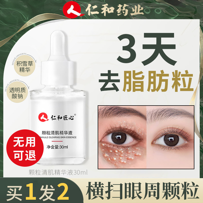 脂肪粒去除神器眼部汗管瘤扁平疣油脂粒眼角周眼霜专用眼霜精华液
