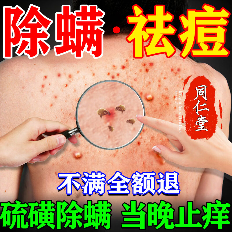 硫磺除螨抑菌止痒杀菌清洁沐浴露毛囊皮炎皮肤瘙痒三合一敷料