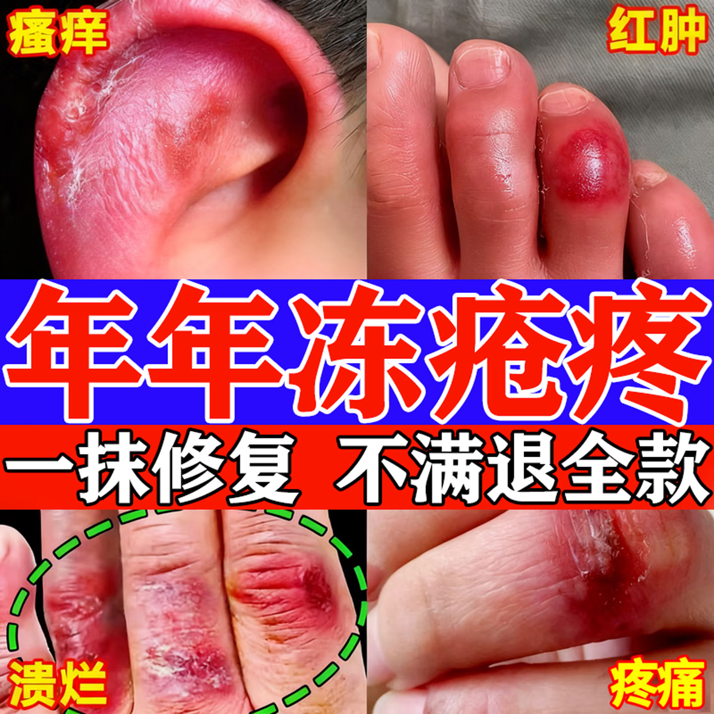 【万人下单】一抹修复冻疮专用膏