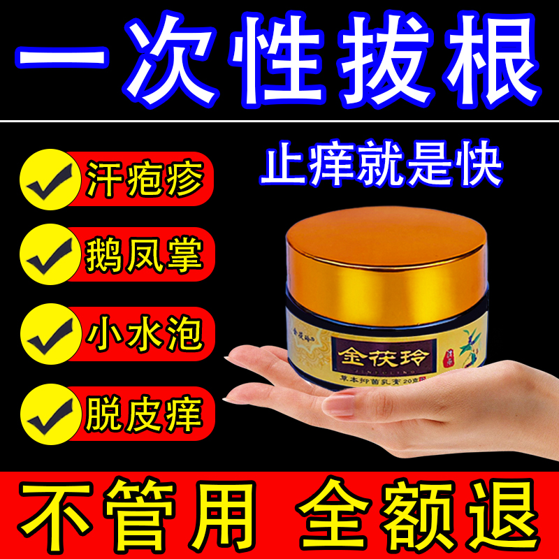 汗泡疱疹药膏手上起小水泡脱皮汗状疱疹止痒汉状真菌感染专用软膏