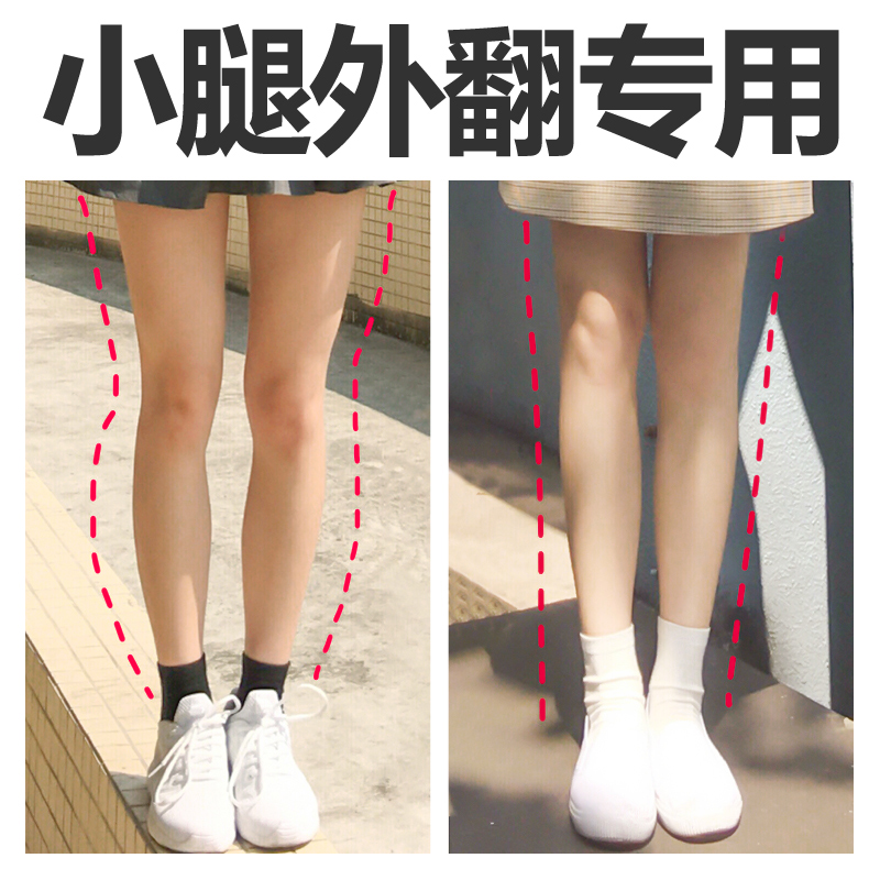 小腿外翻矫正o型腿鞋垫直腿神器xo型腿改善腿型纠正x