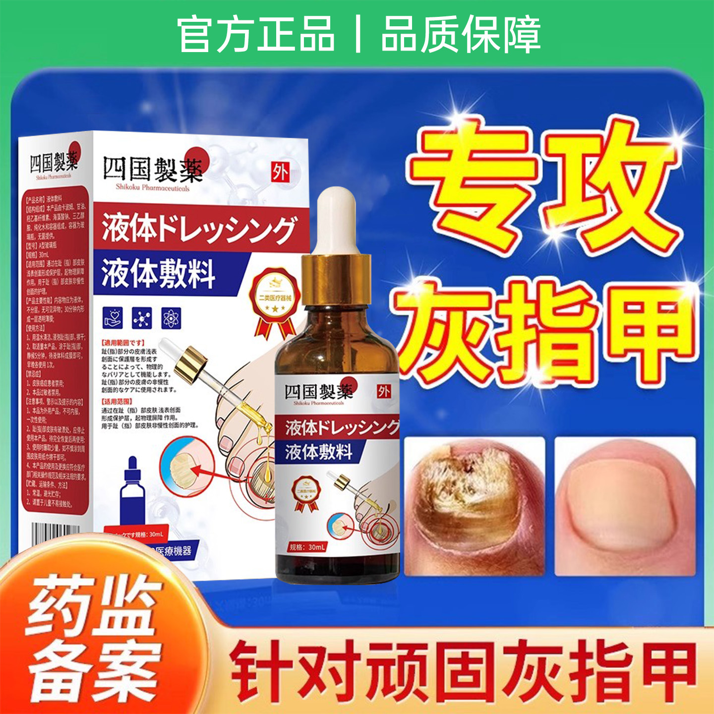 灰指甲真菌感染专用抑菌液剂第一名修复甲沟炎无痛脱甲正品旗舰店