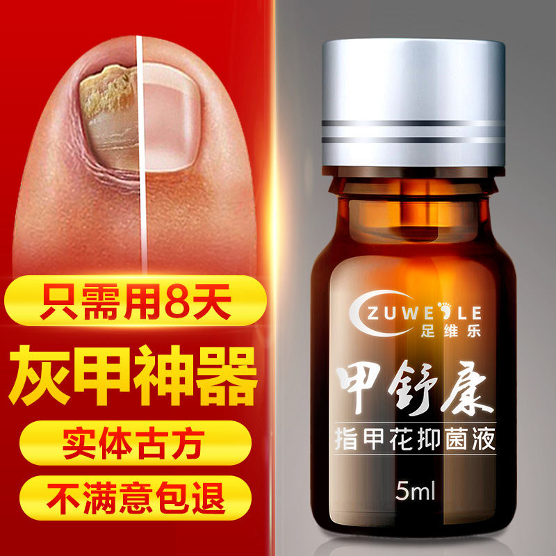 灰指甲神器去除增厚草本抑菌液治療藥软甲脱甲专用药膏冰醋酸正品