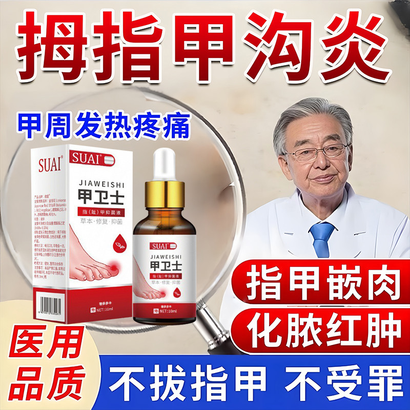 甲沟炎治专用特效膏药脚趾大拇指甲沟炎矫正神器息肉去除软化剂疗