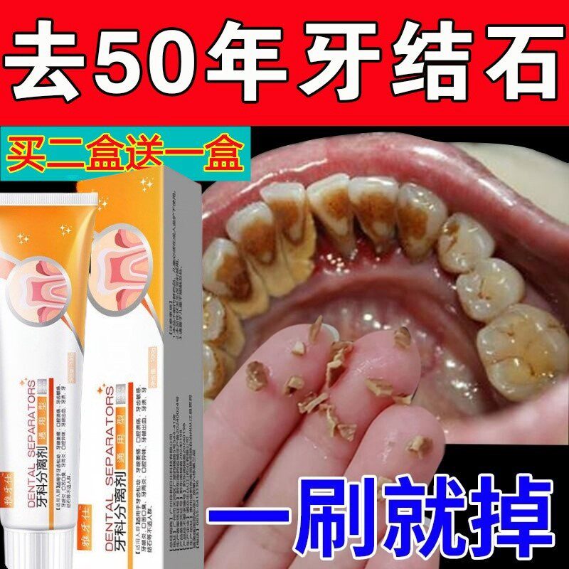 牙膏去黑线黑渍牙窝沟牙齿牙菌斑蛀牙虫洞牙缝发黑牙渍祛除神器