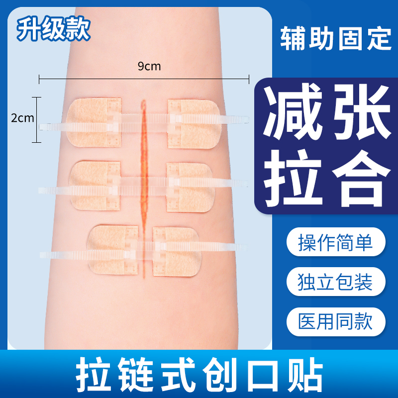 医用减张贴皮肤减张器疤痕伤口拉合免缝针儿童缝合器拉链式创口贴 医疗器械 创口贴 原图主图