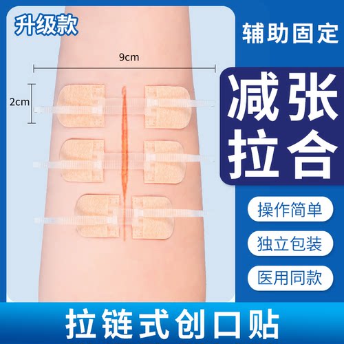 升级款皮肤减张器拉链式创口贴