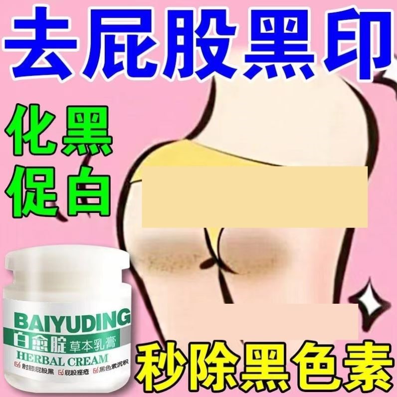 白愈腚乳膏关节手肘胳膊肘去黑死皮脖子腋下去黑色素脚踝膝盖变白