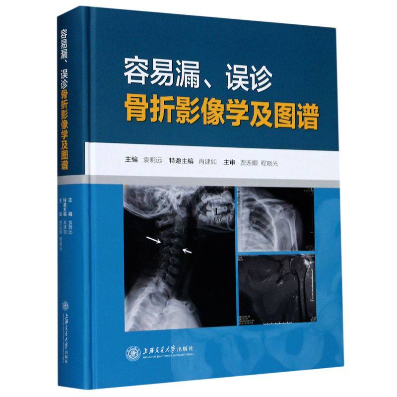 容易漏误诊骨折影像学及图谱(精)