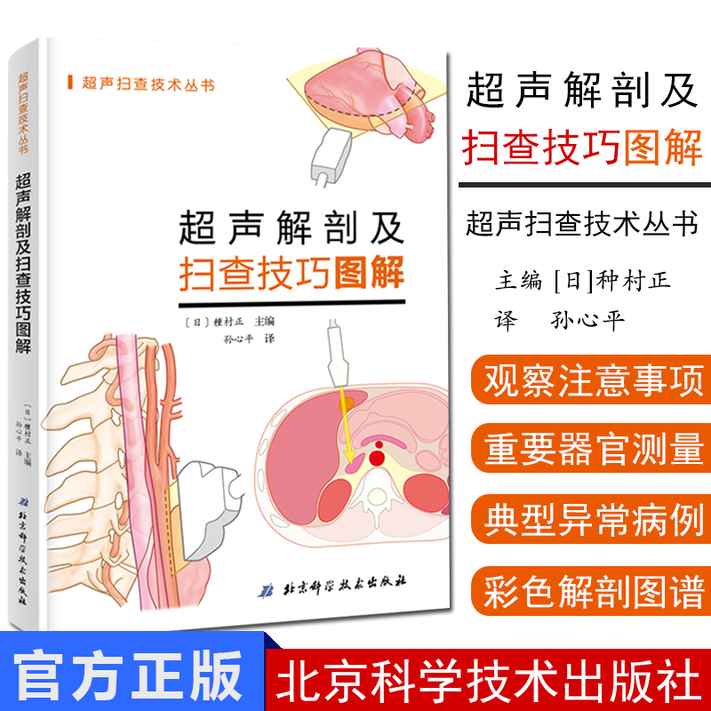超声解剖及扫查技巧图解
