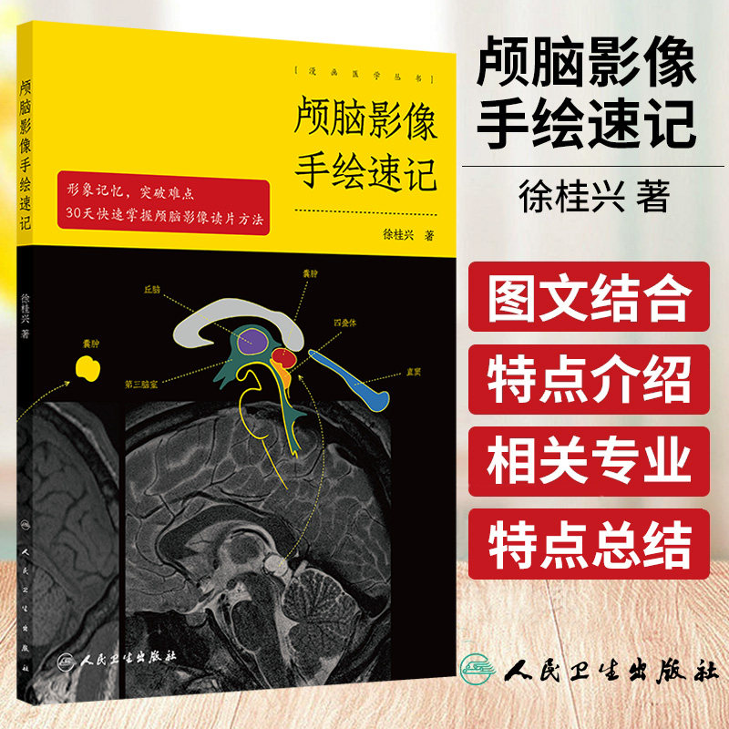 颅脑影像手绘速记 徐桂兴人卫头颅外科神经mri诊断解剖ct读片脑部脑血管重症超声颅内肿瘤图谱放射技术中级人民卫生出版社医学影像