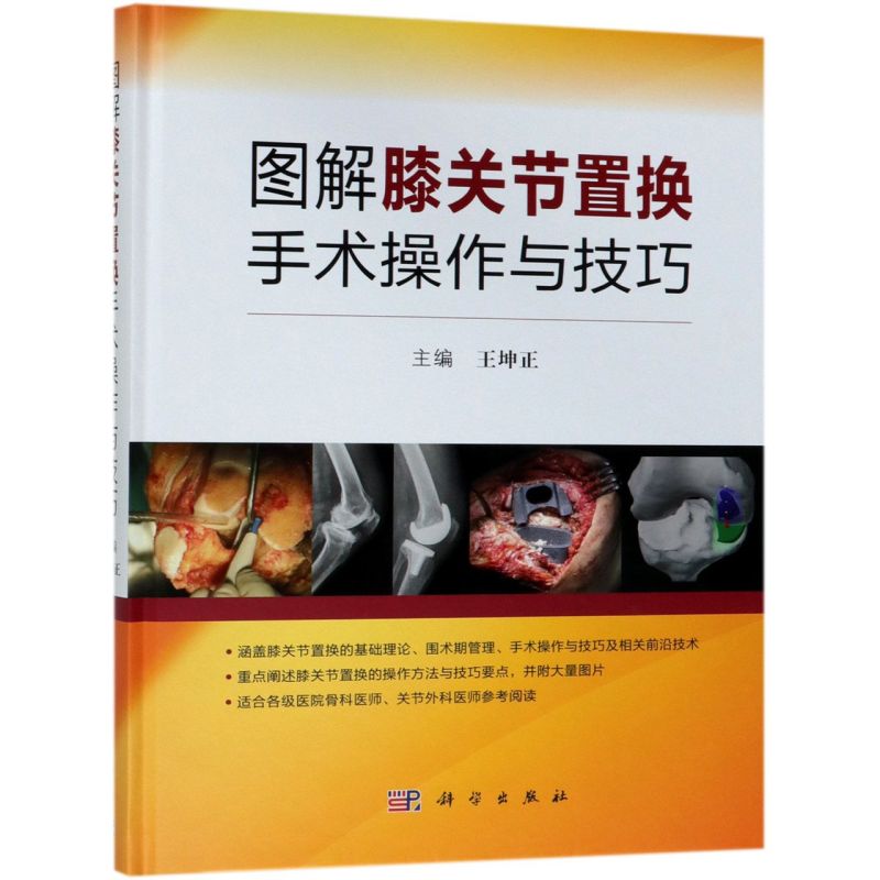 图解膝关节置换手术操作与技巧(精)