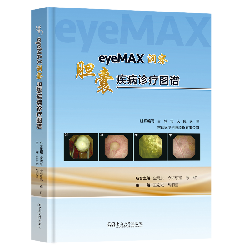 eyeMAX洞察:胆囊疾病诊疗图谱