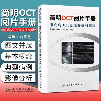 新华正版 简明OCT阅片手册 眼底病OCT影像分析与解读 俞素勤编著 基础阅片影像眼科学视光技术应用 人民卫生出版社9787117157551