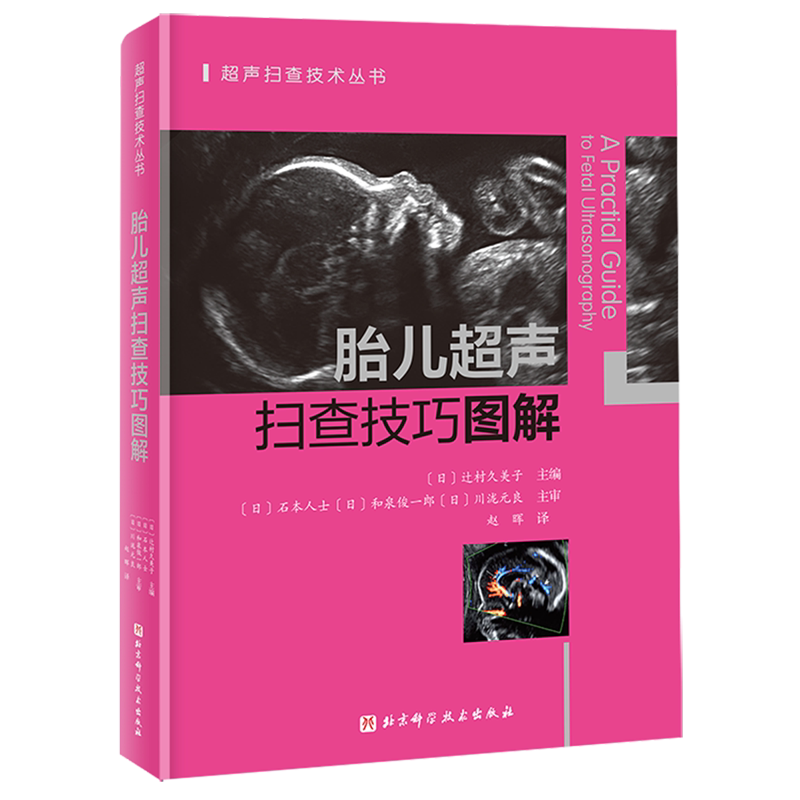 胎儿超声扫查技巧图解