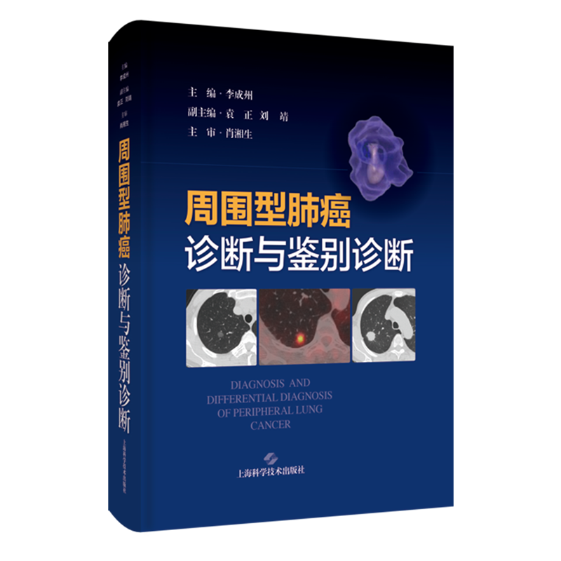周围型肺癌诊断与鉴别诊断