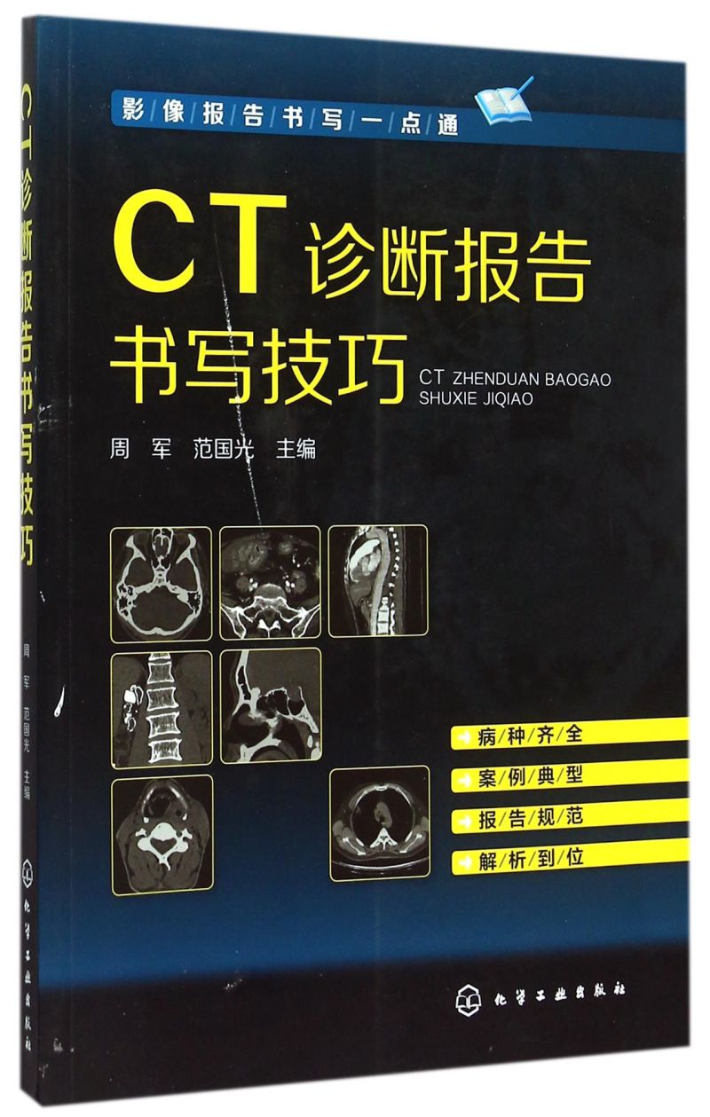 影像报告书写一点通 CT诊断报告书写技巧 CT图谱大全 医学影像报告书写一点通 看片读片指南 新手学拍片教程 医学影像技术应用书籍