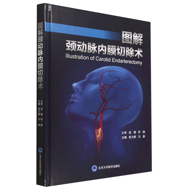 图解颈动脉内膜切除术