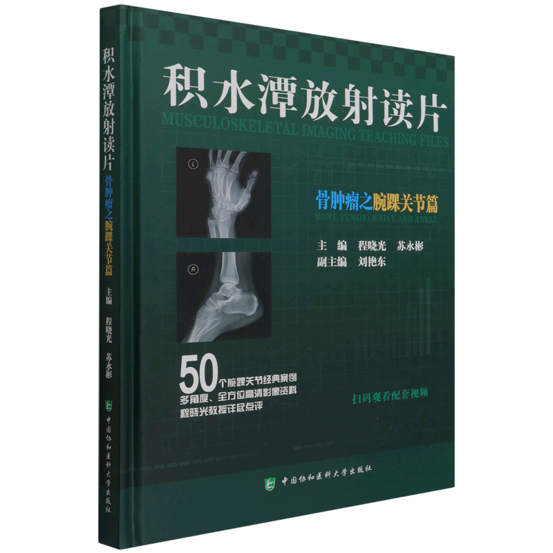 积水潭放射读片(骨肿瘤之腕踝关节篇)(精)