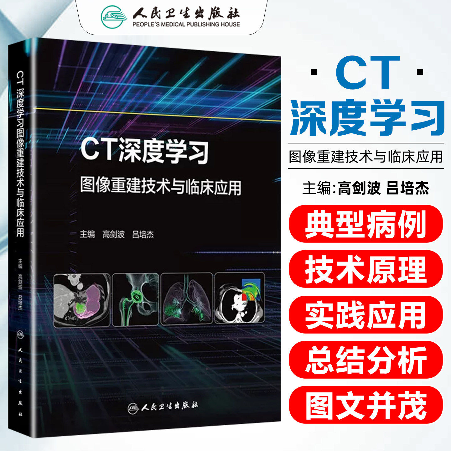 CT深度学习图像重建技术与临床应用 高剑波 吕培杰 本书主要阐述了DLIR算法在各部位疾病检查中的临床应用等 人民卫生出版社