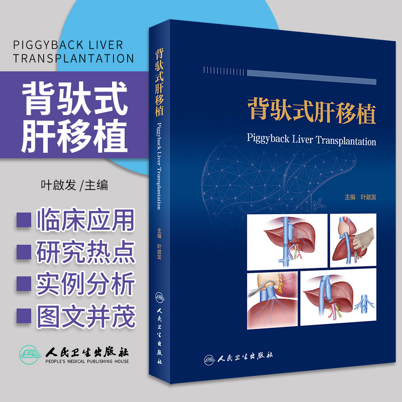 背驮式肝移植 叶啟发主编 背驮式肝移植基础研究临床应用 肝移植术前及术后管理 创新术式规范解读 人民卫生出版社9787117337618