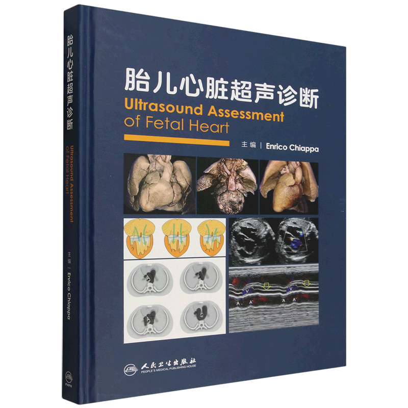 胎儿心脏超声诊断