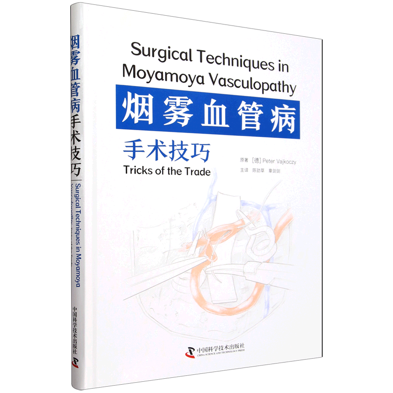 烟雾血管病手术技巧Thieme出版社原版引进柏林洪堡大学医学院神经外科与儿童神经外科系主任PeterVajkoczy教授领衔