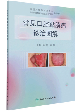 常见口腔黏膜病诊治图解 华红周刚溃疡感染疱疹唇舌斑纹类疾病激光治疗药物抗真菌护理人民卫生出版社医学口腔书籍
