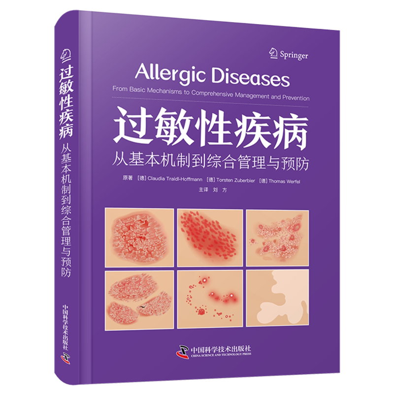 过敏性疾病:从基本机制到综合管理与预防