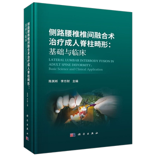 侧路腰椎椎间融合术治疗成人脊柱畸形:基础与临床