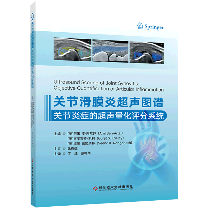 关节滑膜炎超声图谱:关节炎症的超声量化评分系统