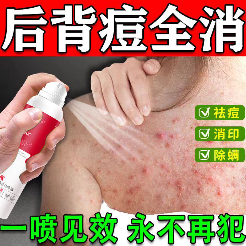 【痘立消】前胸后背祛痘身体喷雾