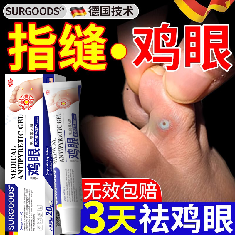 【官方旗舰店】鸡眼膏专用去除根