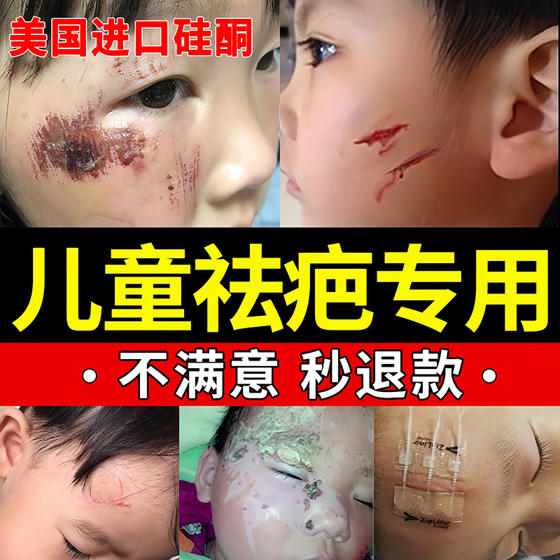 芭克去祛疤膏儿童小孩巴疤痕修复除凝胶官方旗舰店正品QF