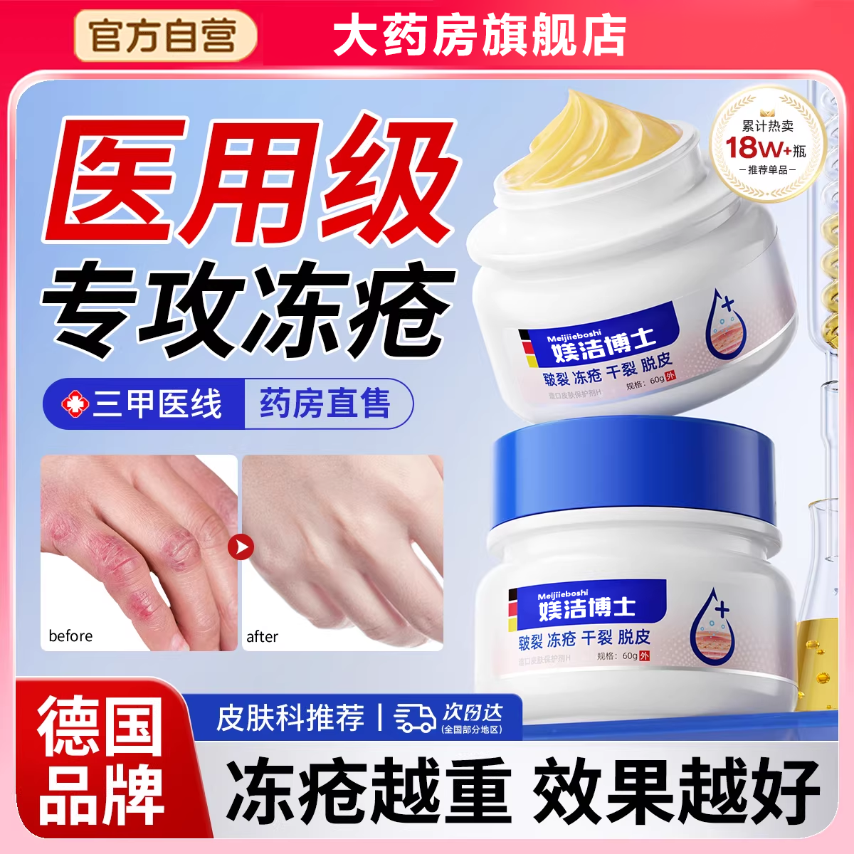 医用冻疮膏止痒冻伤膏正品效防儿童冻裂耳朵消肿修复护手足霜药bx