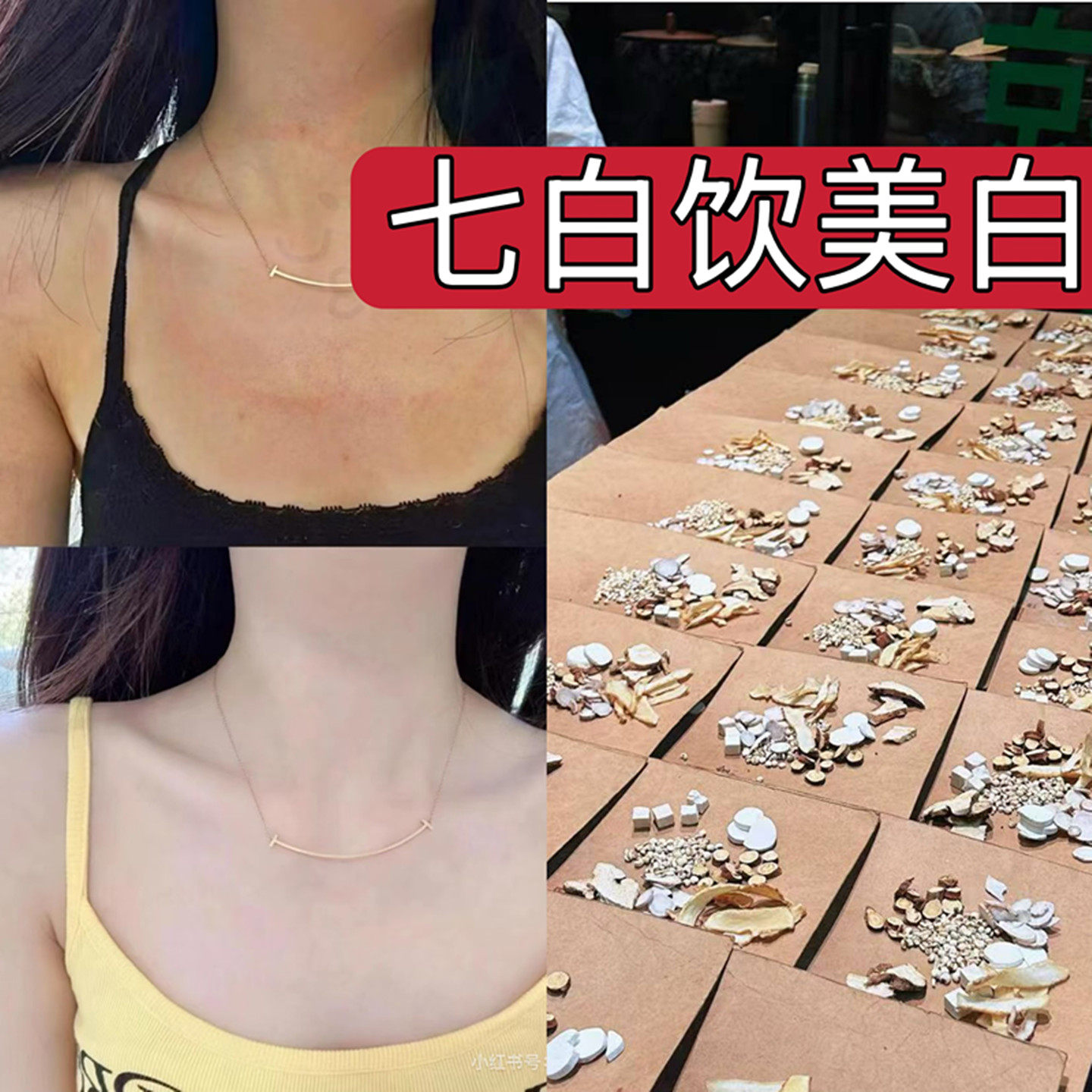 杭州第一医院【七白饮】增白美肤 肤色萎黄 毛孔粗大 皮肤干燥