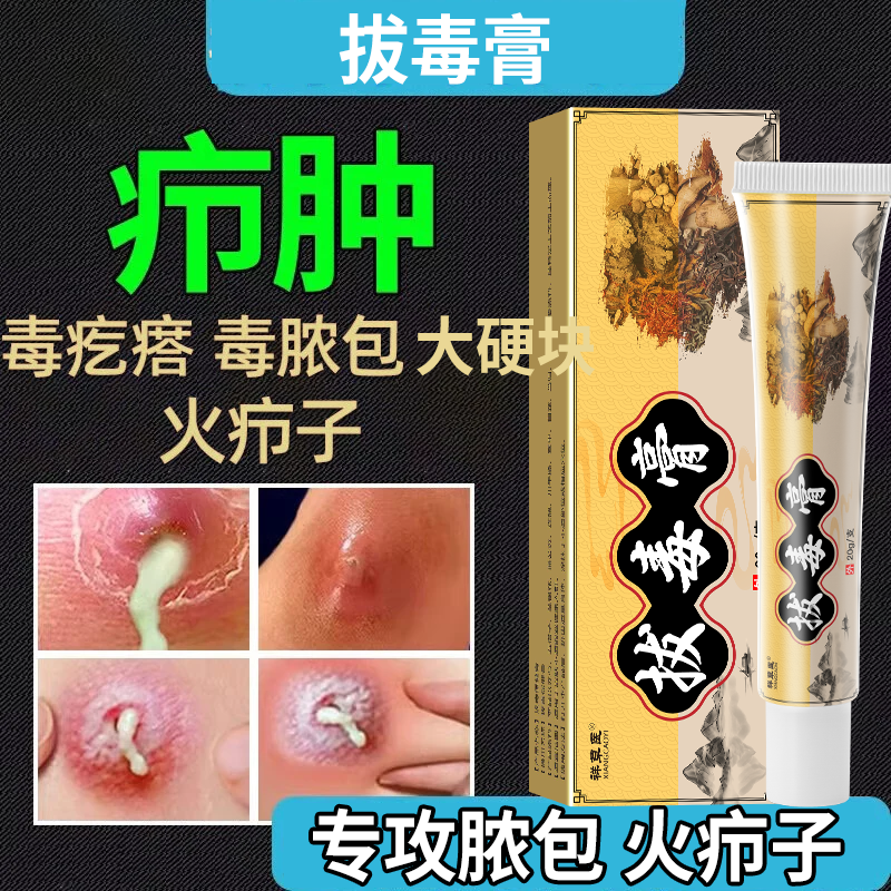 久坐痔疮红痒火疖子拔毒膏